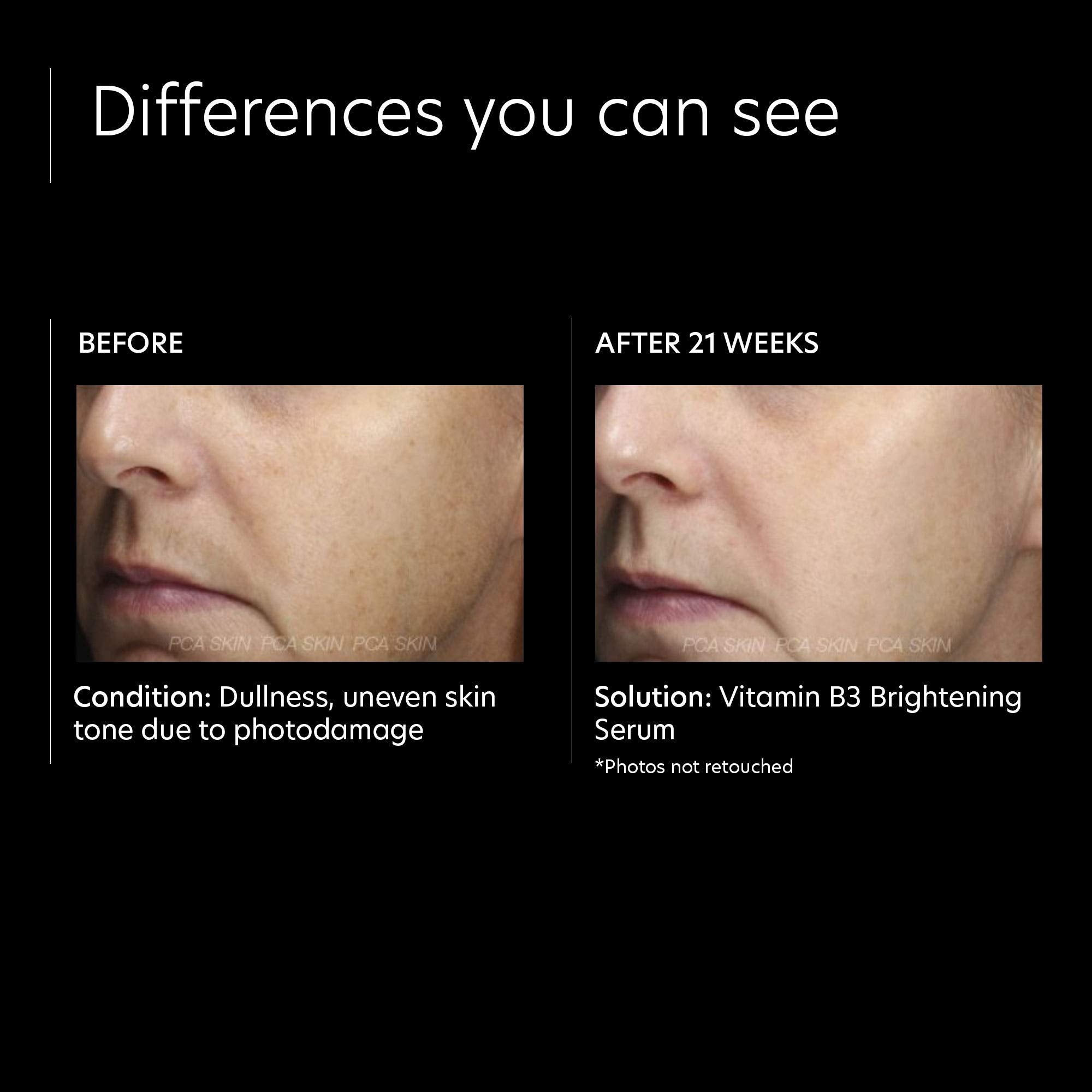 PCA Skin Vitamin B3 Brightening Serum - Skin Love Cream