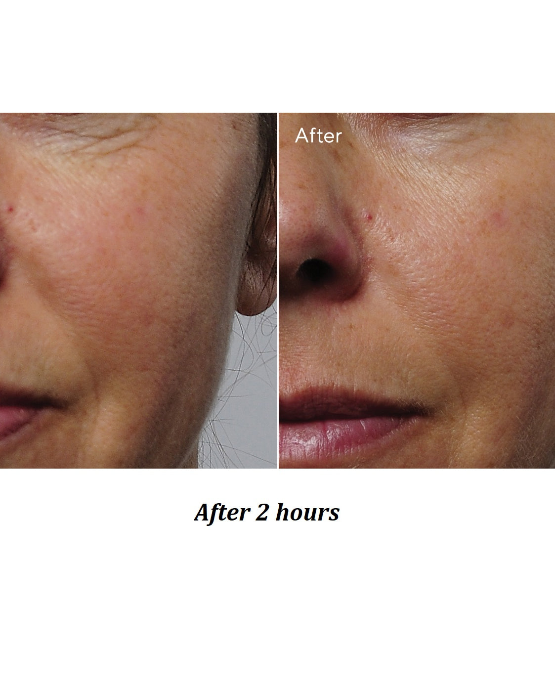 Murad Rapid Collagen Infusion - Skin Love Cream