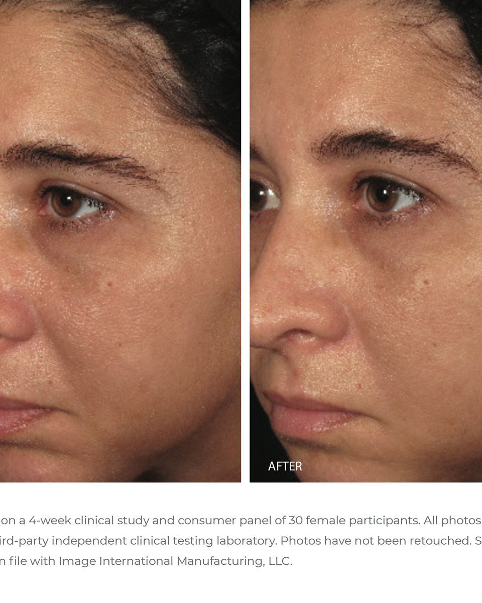 IMAGE Skincare ORMEDIC Balancing Biopeptide Crème - Skin Love Cream