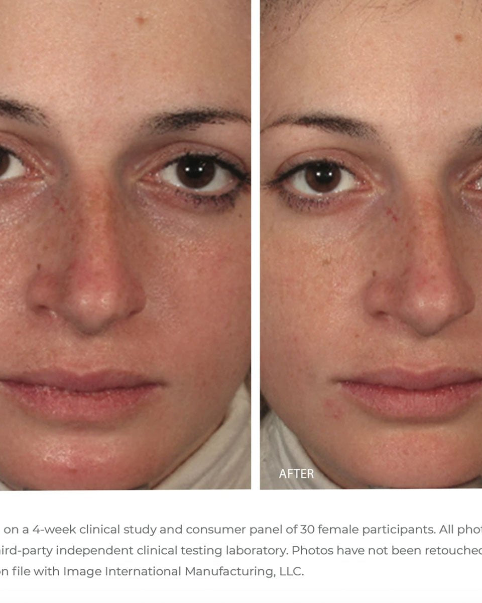 IMAGE Skincare ORMEDIC Balancing Gel Masque - Skin Love Cream