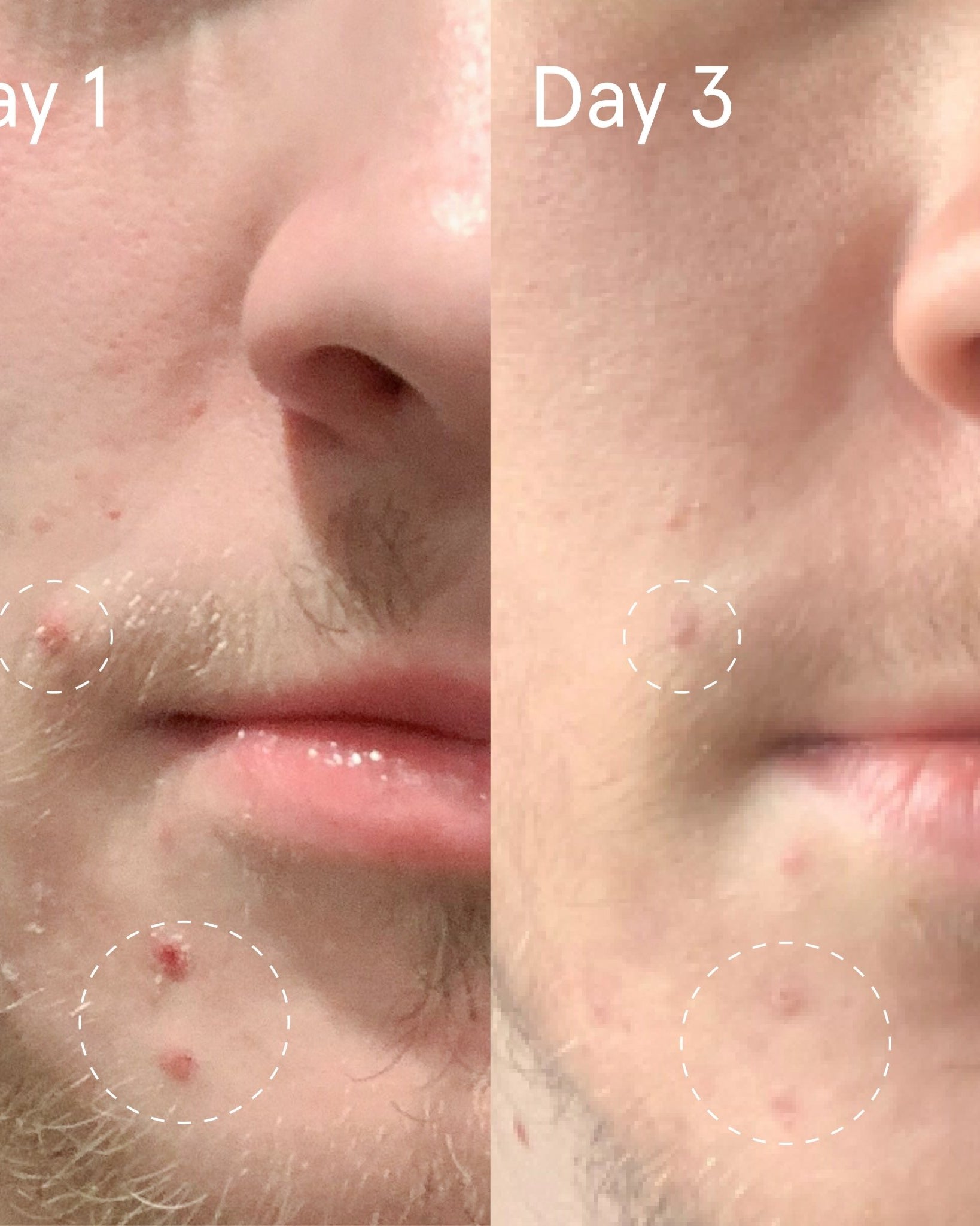 Face Reality Sulfur Spot Treatment - Skin Love Cream