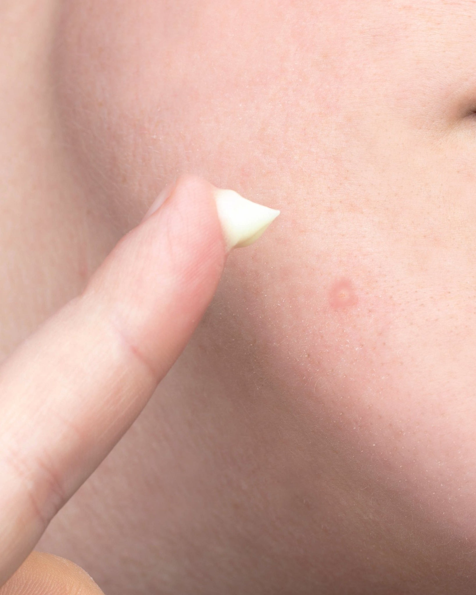 Face Reality Sulfur Spot Treatment - Skin Love Cream