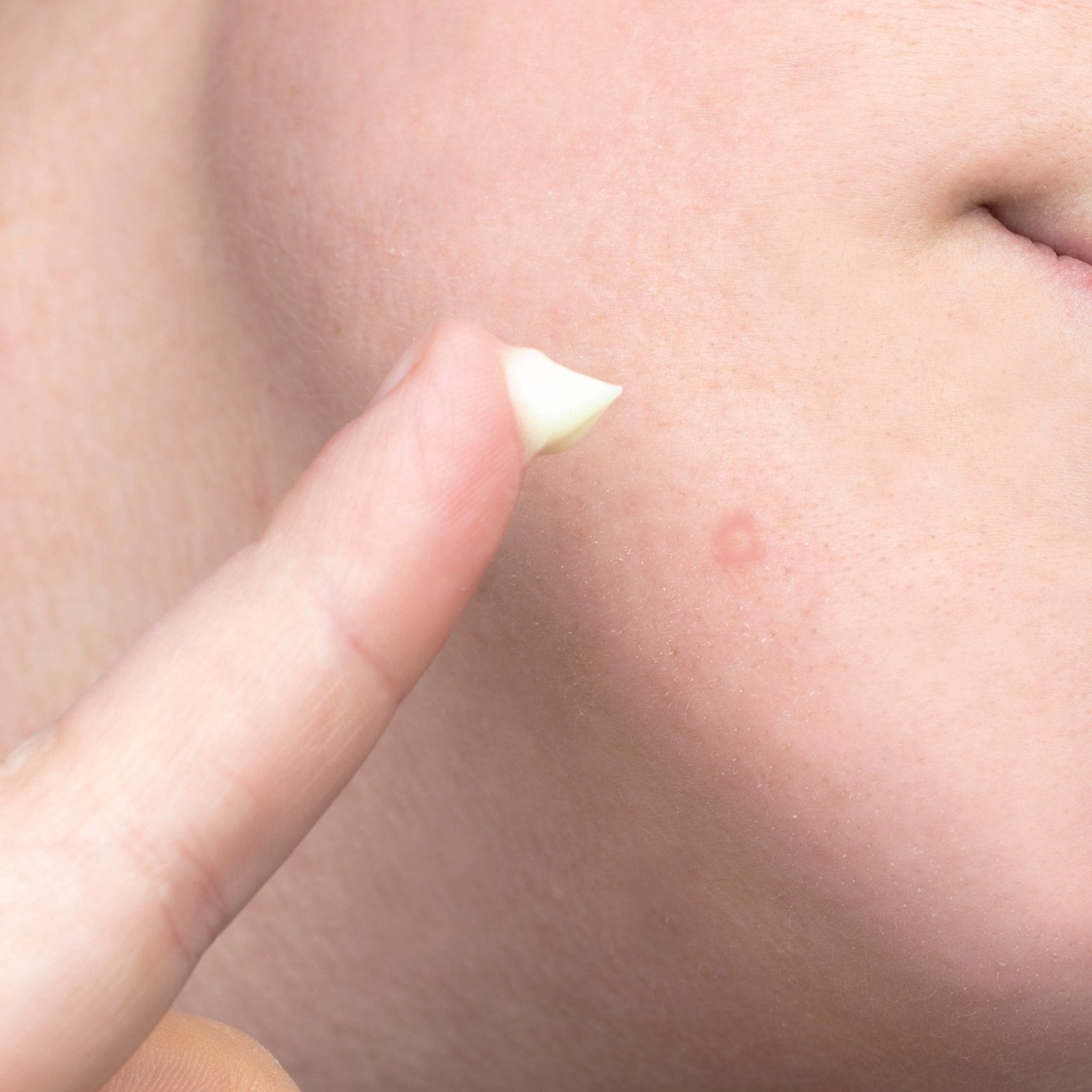 Face Reality Sulfur Spot Treatment - Skin Love Cream