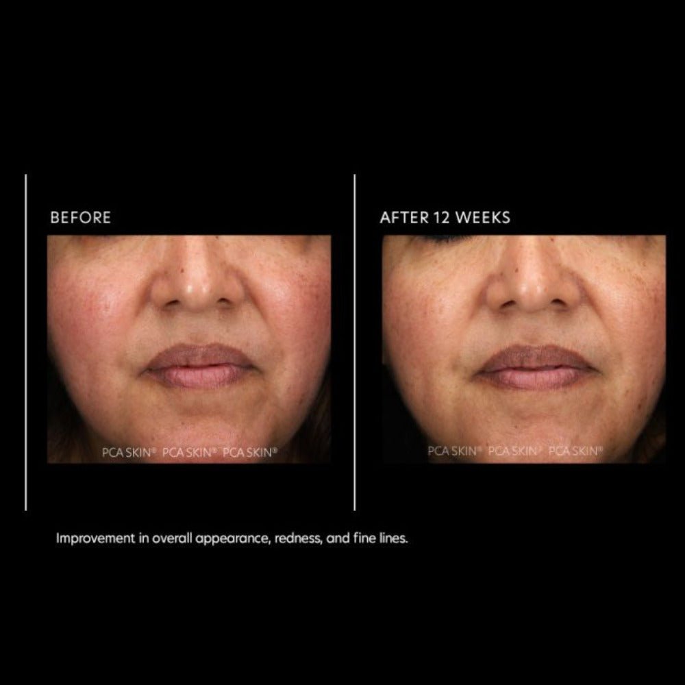 PCA Skin Resurfacing Serum - Skin Love Cream