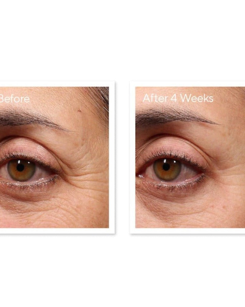 Murad Retinol Youth Renewal Eye Serum - Skin Love Cream