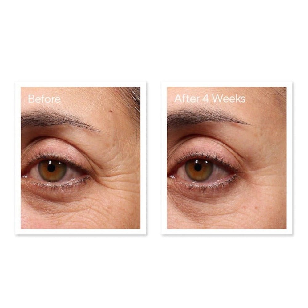 Murad Retinol Youth Renewal Eye Serum - Skin Love Cream