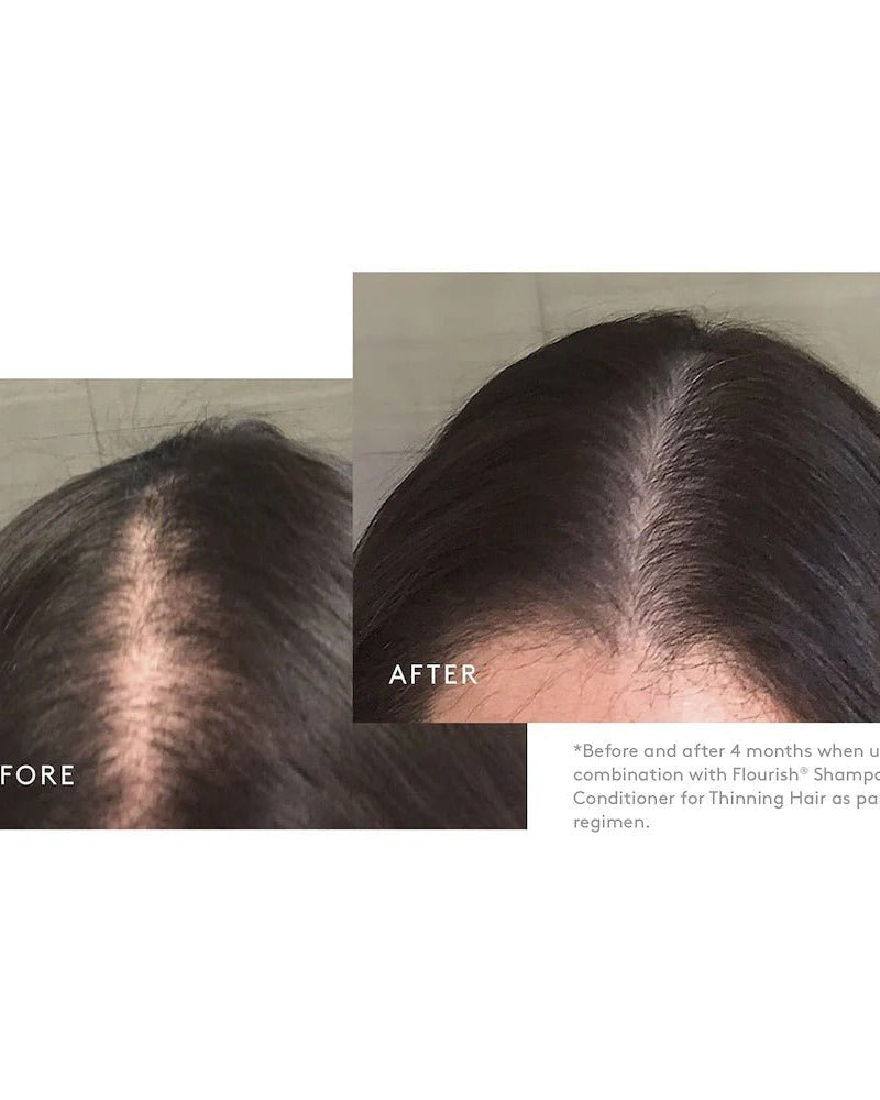 VIRTUE Flourish Minoxidil Foam 5 For Women - Skin Love Cream