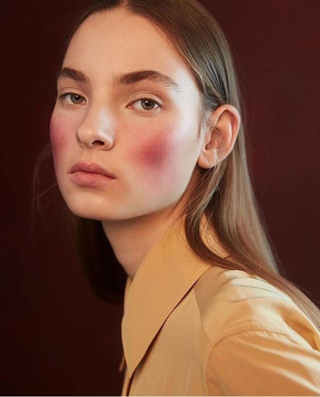 Rosacea: What is this & what you need to know about it? - Skin Love Cream