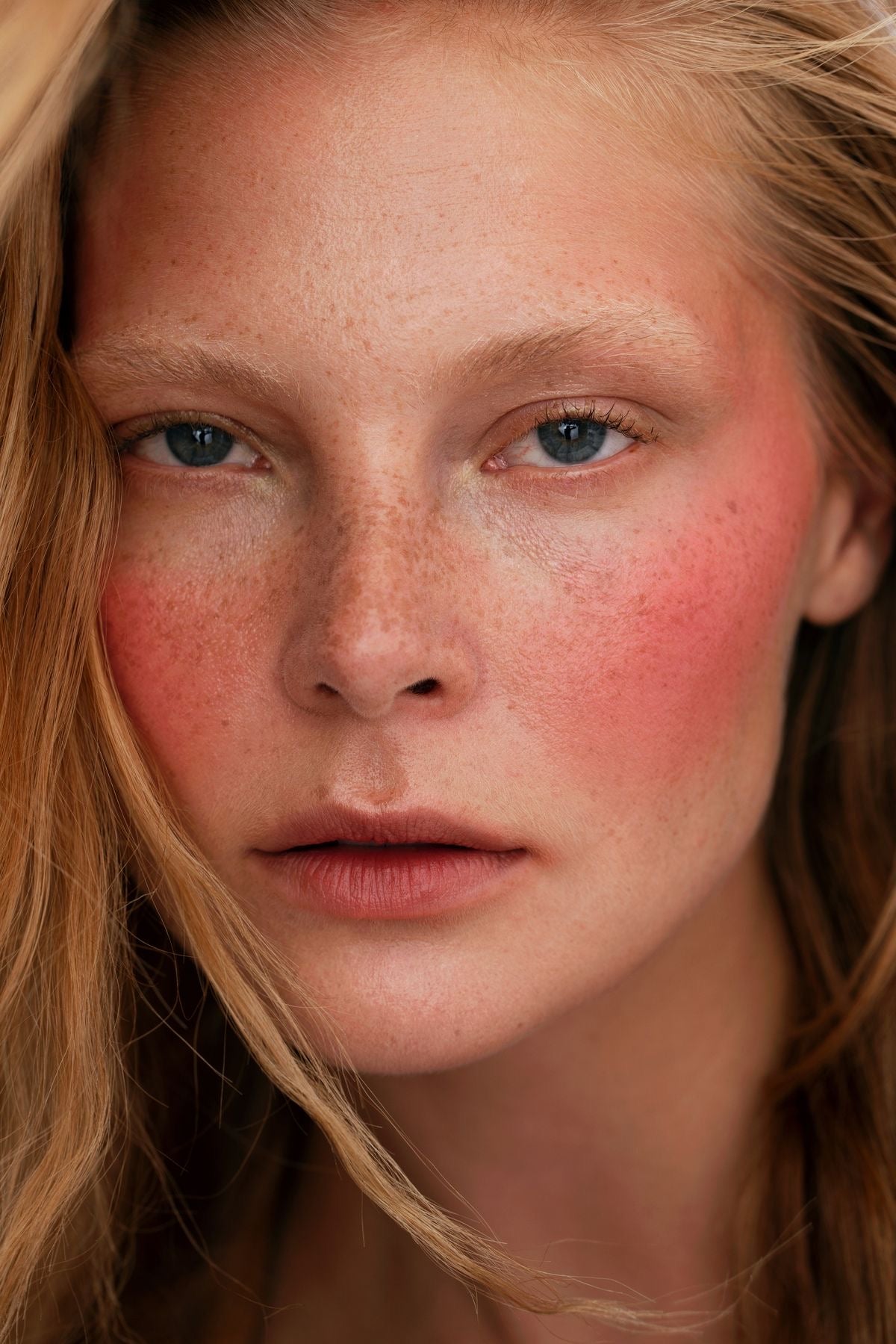 5 Golden Rules for Treating Hyperpigmentation - Skin Love Cream