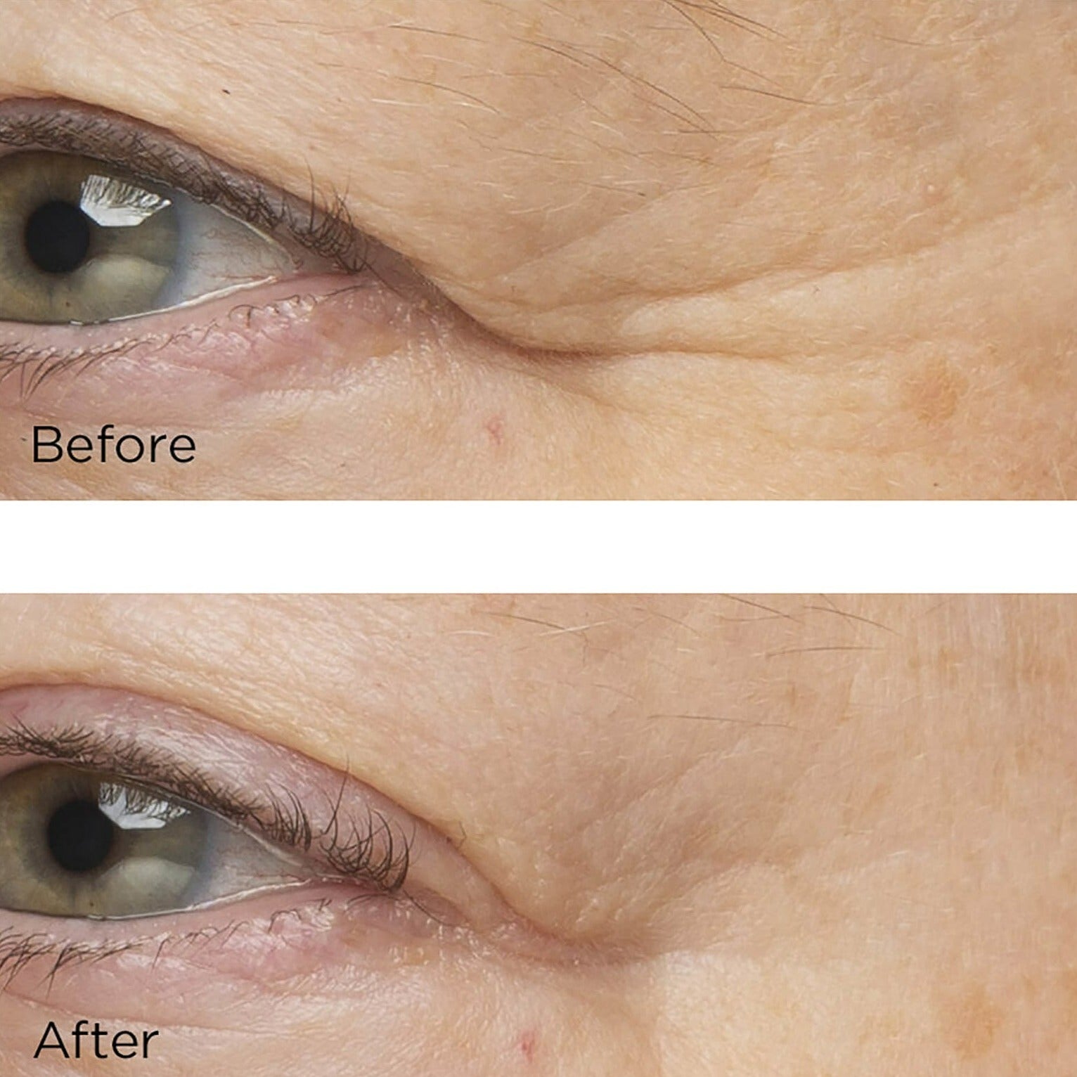 Perricone MD Cold Plasma Plus+ The Intensive Hydrating Complex - Skin Love Cream