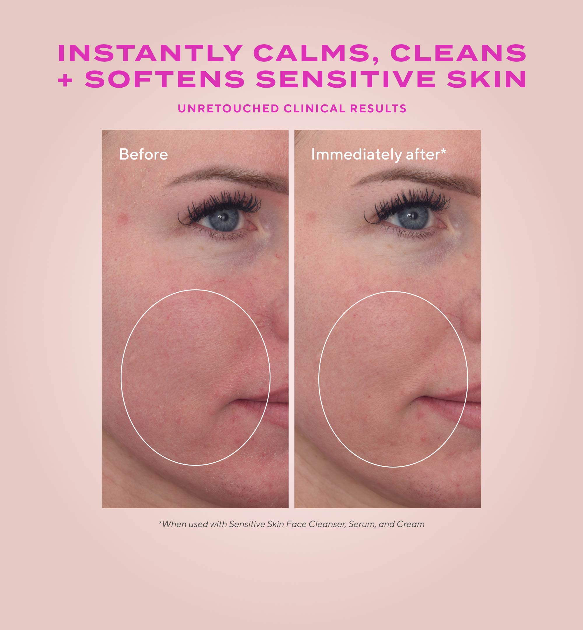 Murad Heartleaf Soothing Cleanser - Skin Love Cream