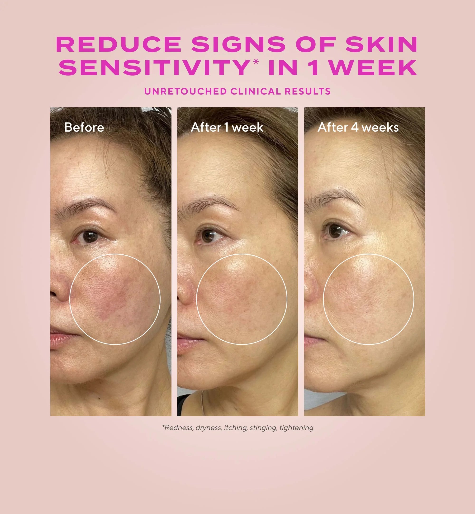 Murad Heartleaf Gentle Resurfacing Serum - Skin Love Cream