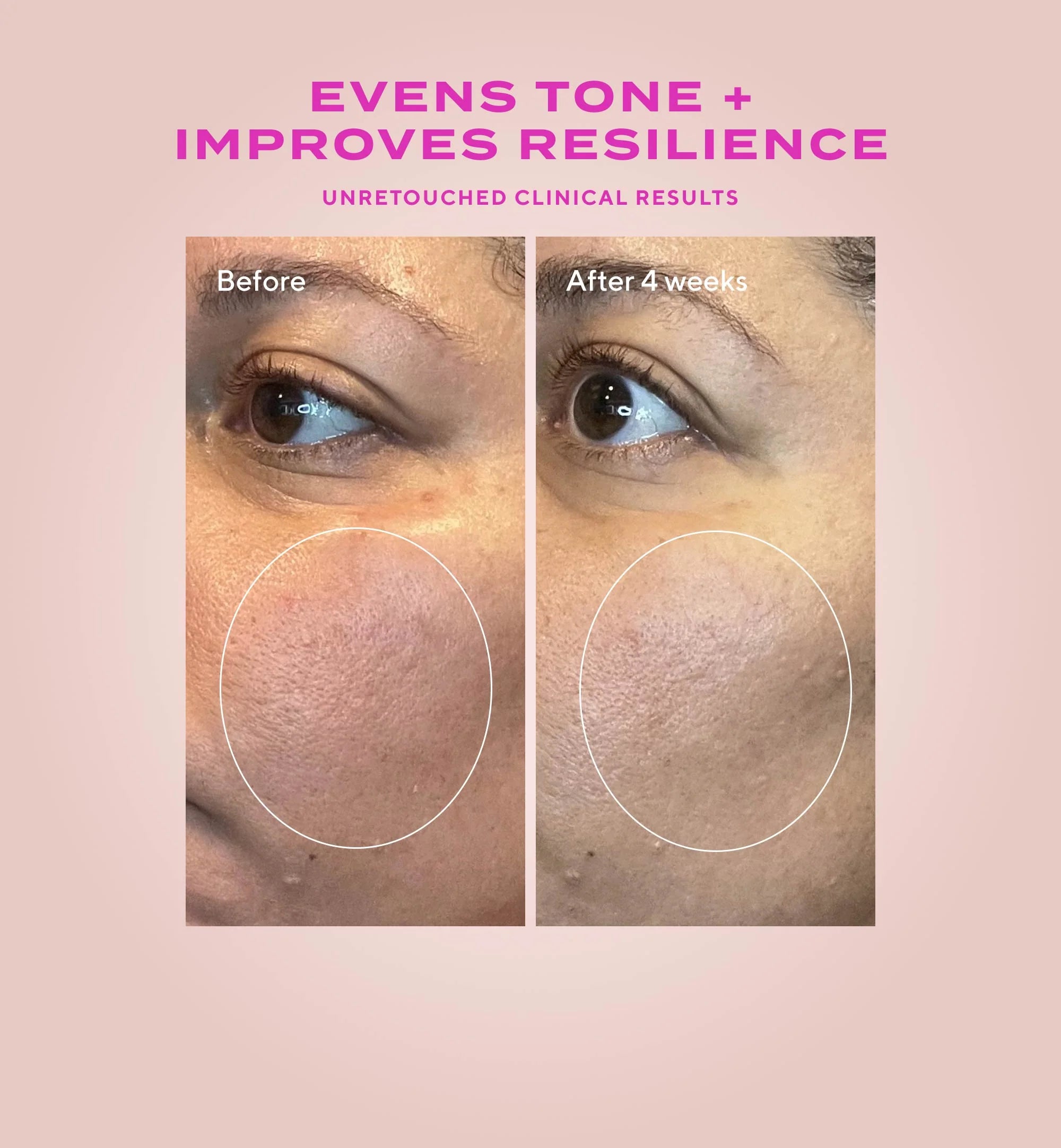 Murad Heartleaf Gentle Resurfacing Serum - Skin Love Cream