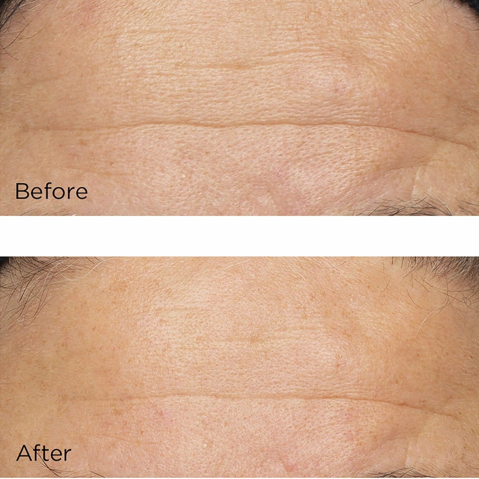 Perricone MD Cold Plasma Plus+ The Intensive Hydrating Complex - Skin Love Cream