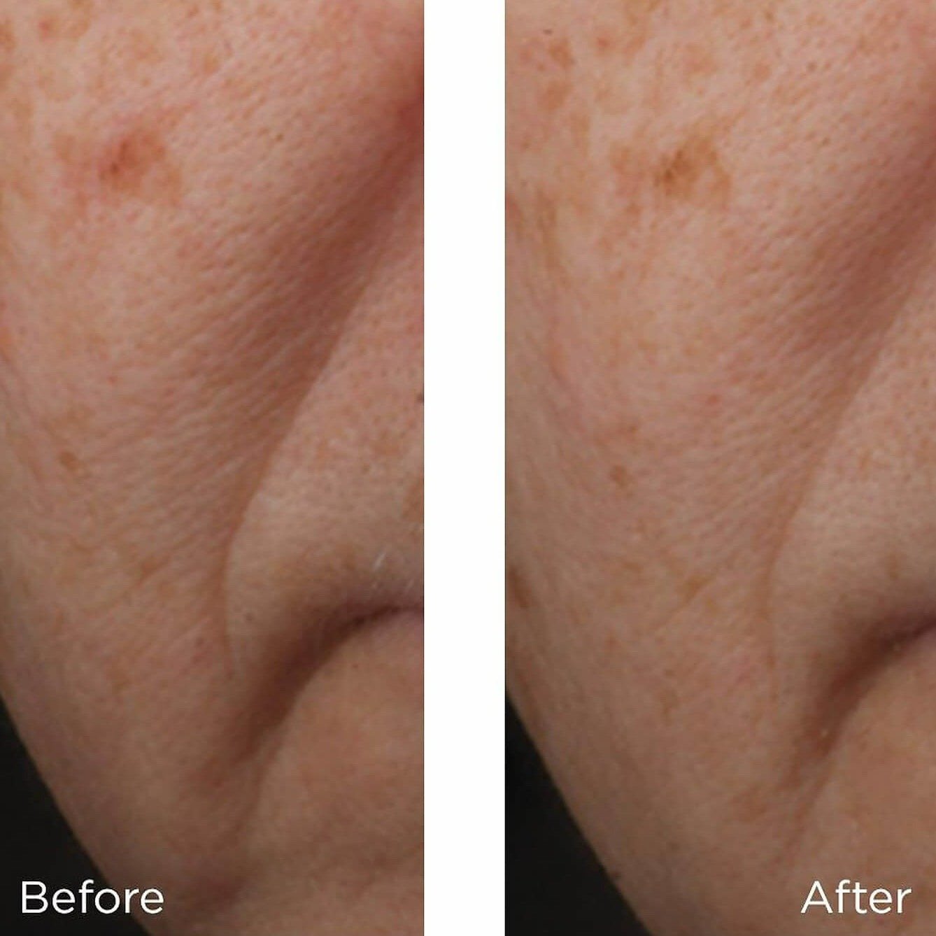 Perricone MD Cold Plasma Plus+ Advanced Serum Concentrate - Skin Love Cream