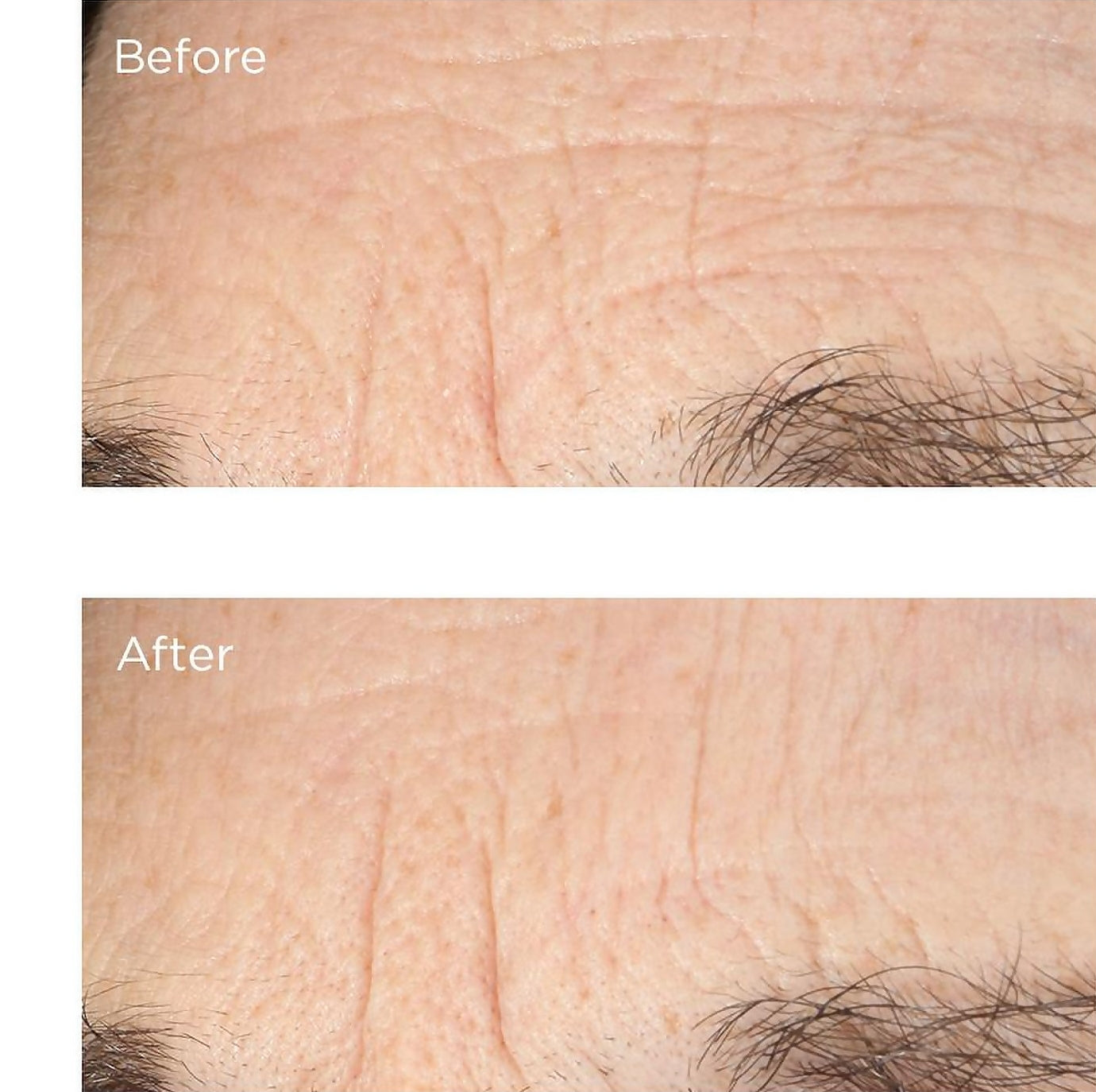 Perricone MD Essential Fx Acyl-Glutathione Deep Crease Serum