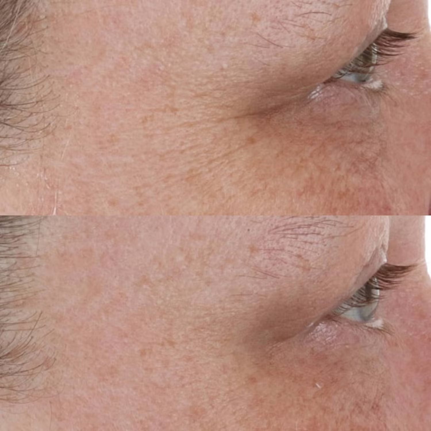 Perricone MD High Potency Retinol Recovery Overnight Moisturizer - Skin Love Cream