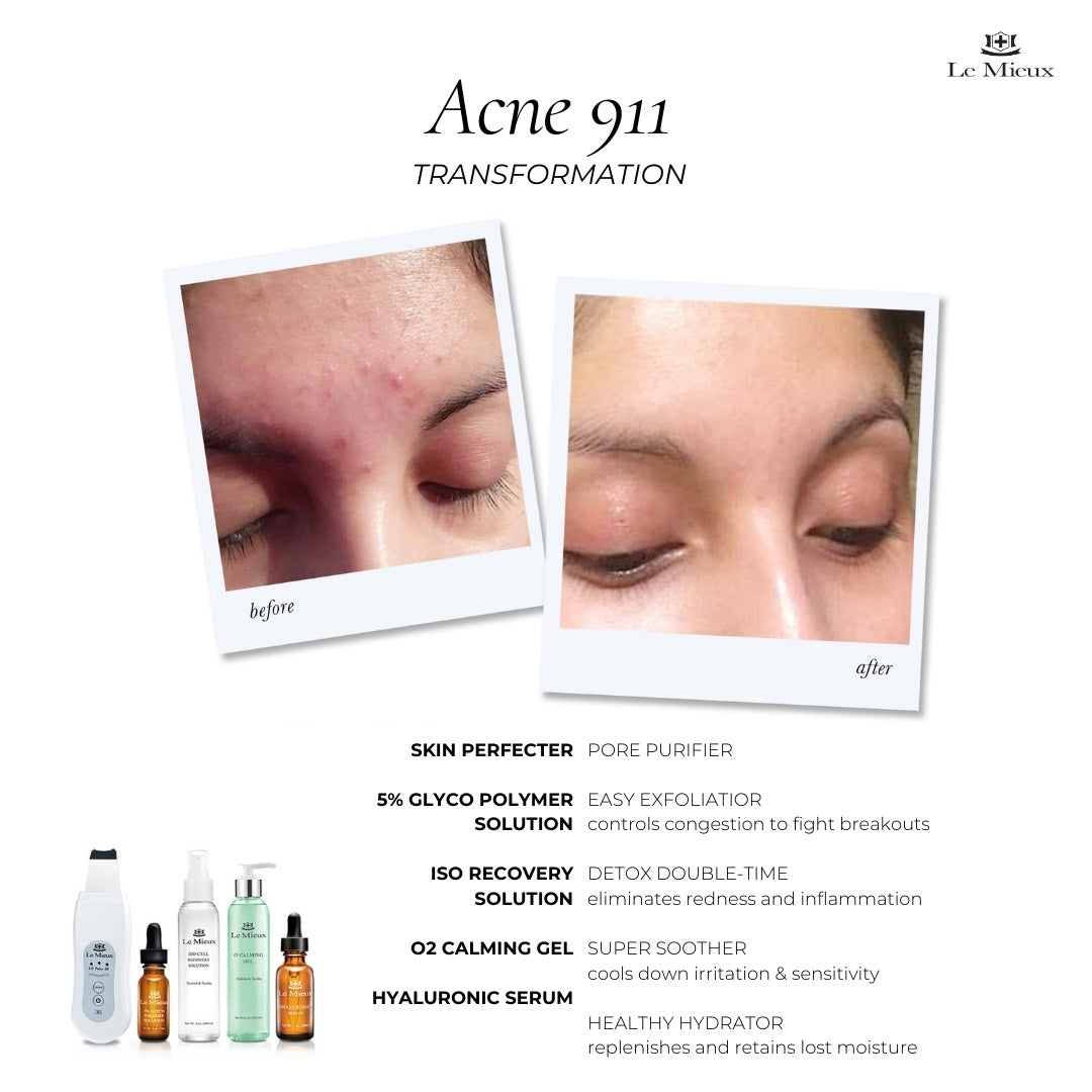 Le Mieux Acne 911 Transformation Bundle