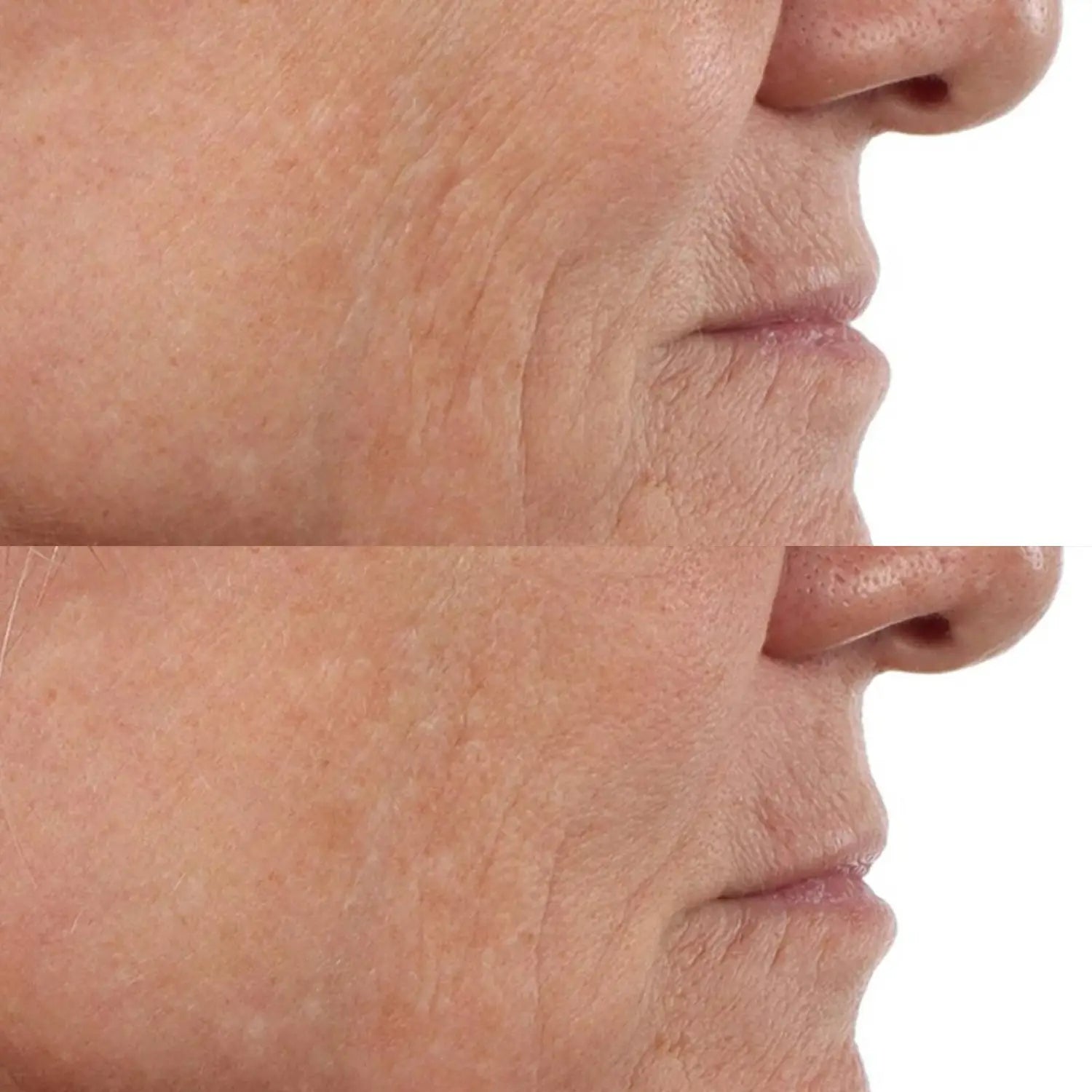 Perricone MD Vitamin C Ester CCC + Ferulic Brightening Complex 20% - Skin Love Cream