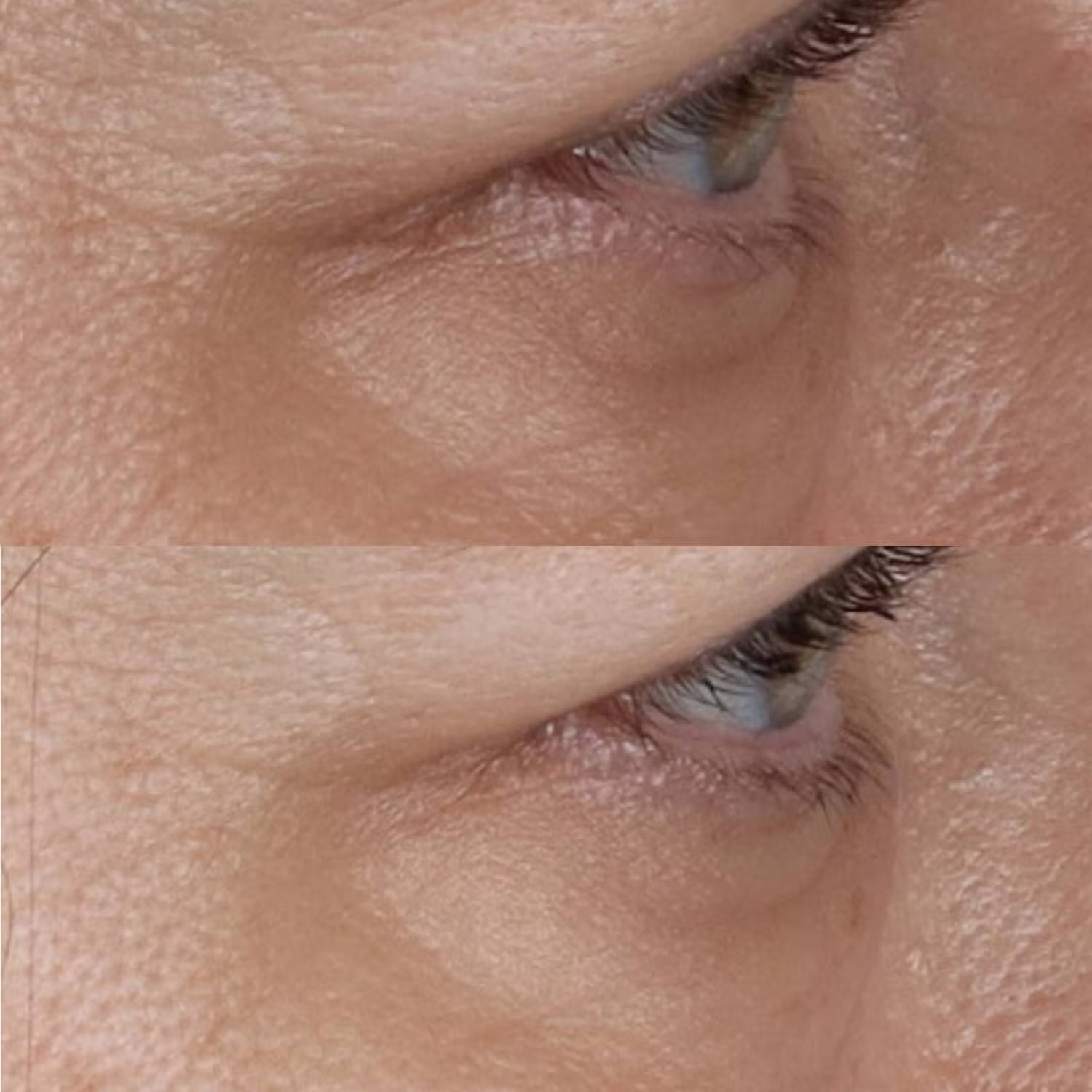 Perricone MD Vitamin C Ester CCC + Ferulic Brightening Under - Eye Cream - Skin Love Cream