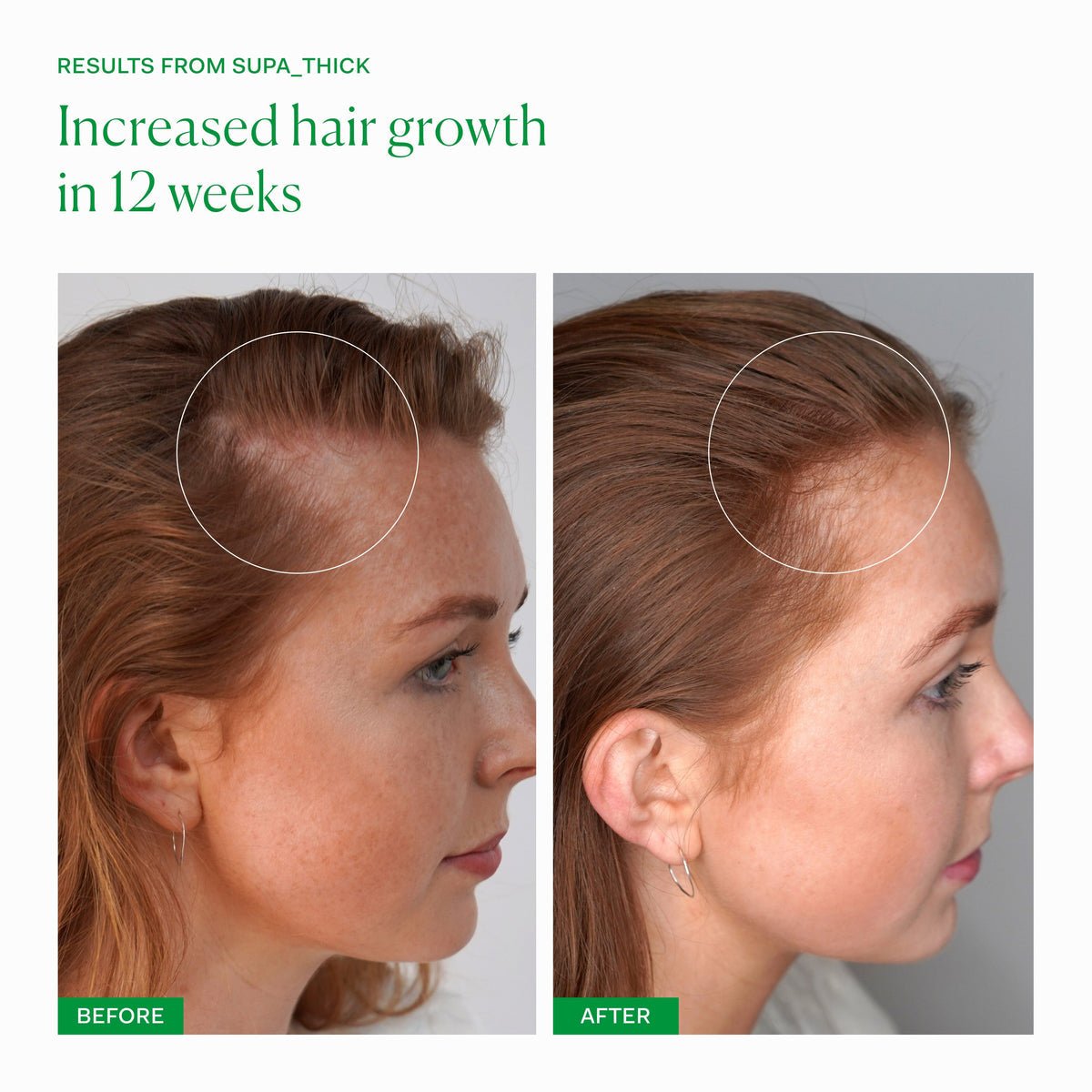 THE NUE CO Supa Thick Scalp Serum - Skin Love Cream