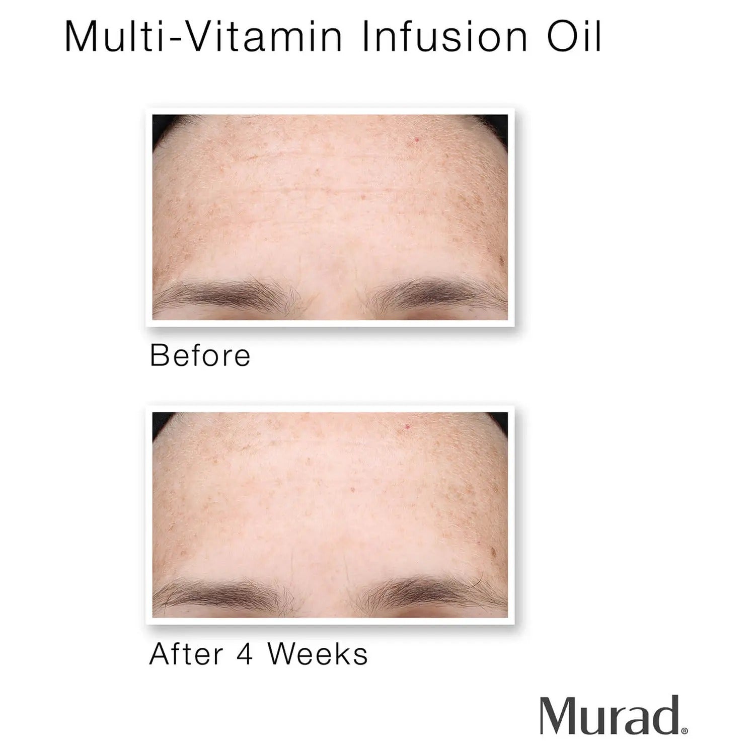 Murad 2024 Multi-Vitamin Infusion Oil