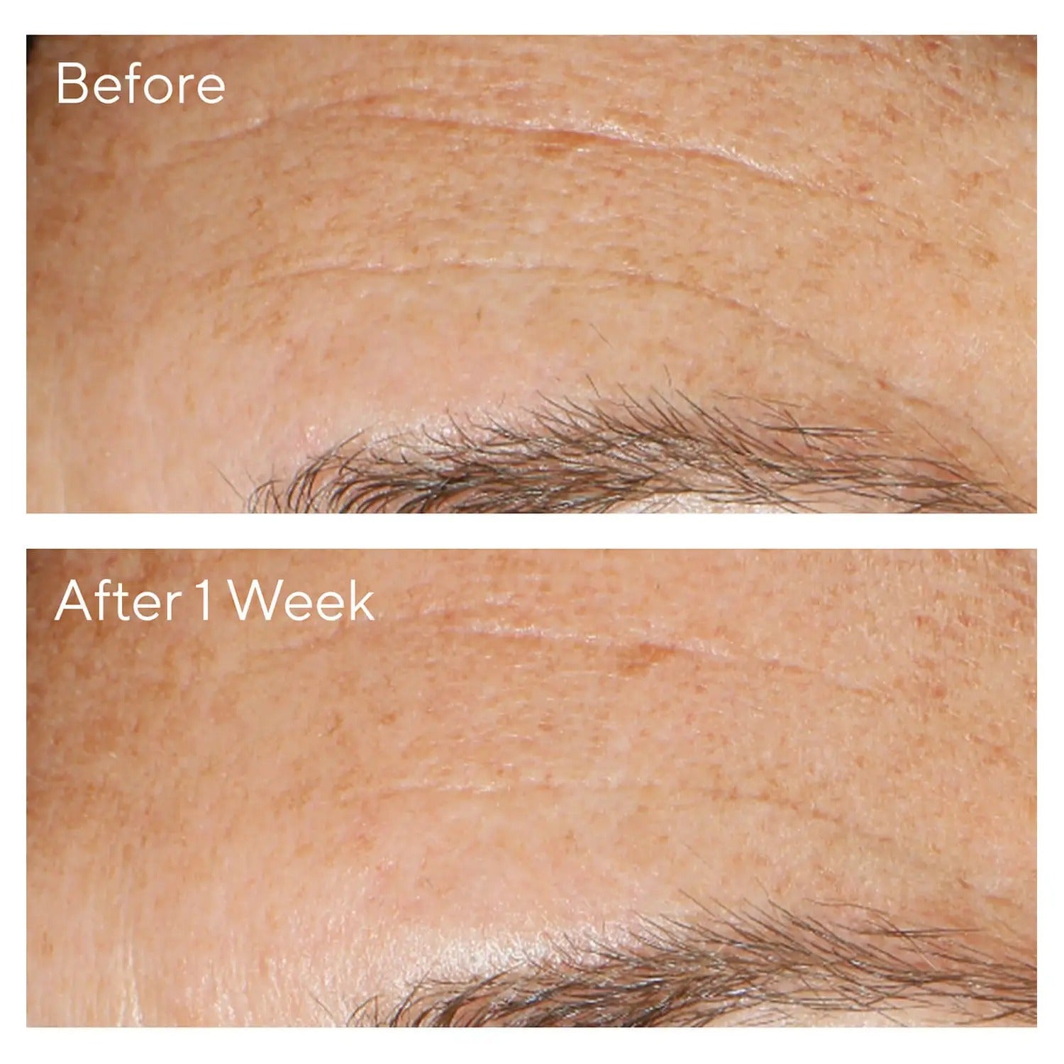 Murad Replenishing Multi - Acid Peel - Skin Love Cream