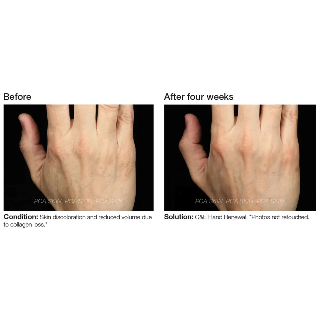 PCA Skin C&E Hand Renewal