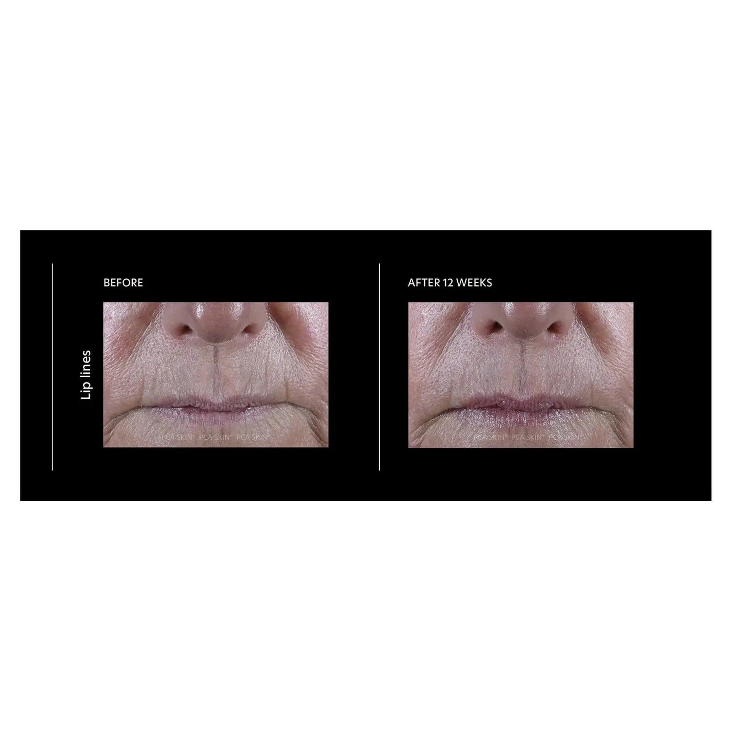 PCA Skin ExLinea Pro Peptide Serum - Skin Love Cream