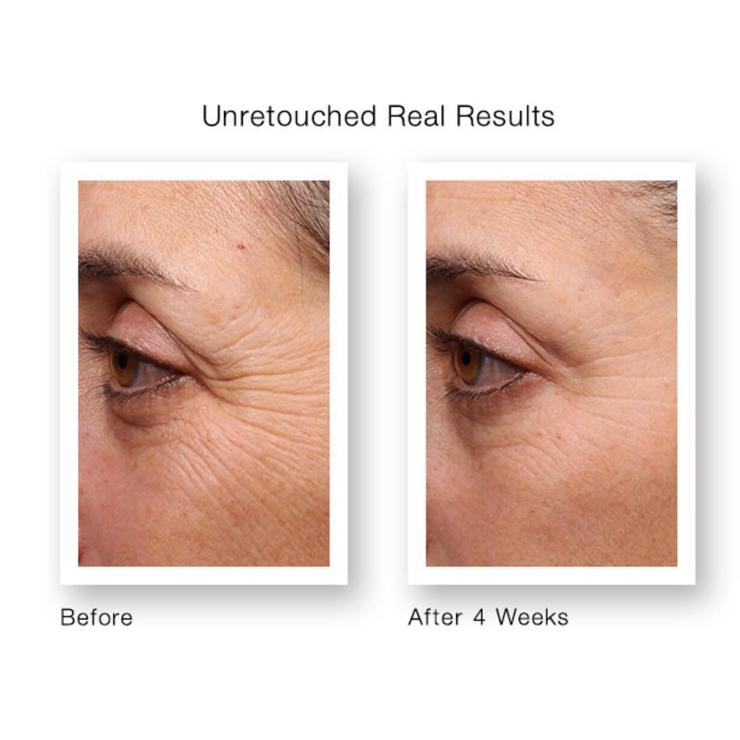 Murad Resurgence Renewing Eye Cream - Skin Love Cream