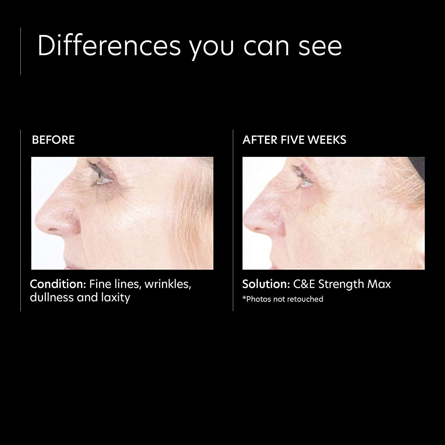 PCA Skin C&E Strength Max - Skin Love Cream