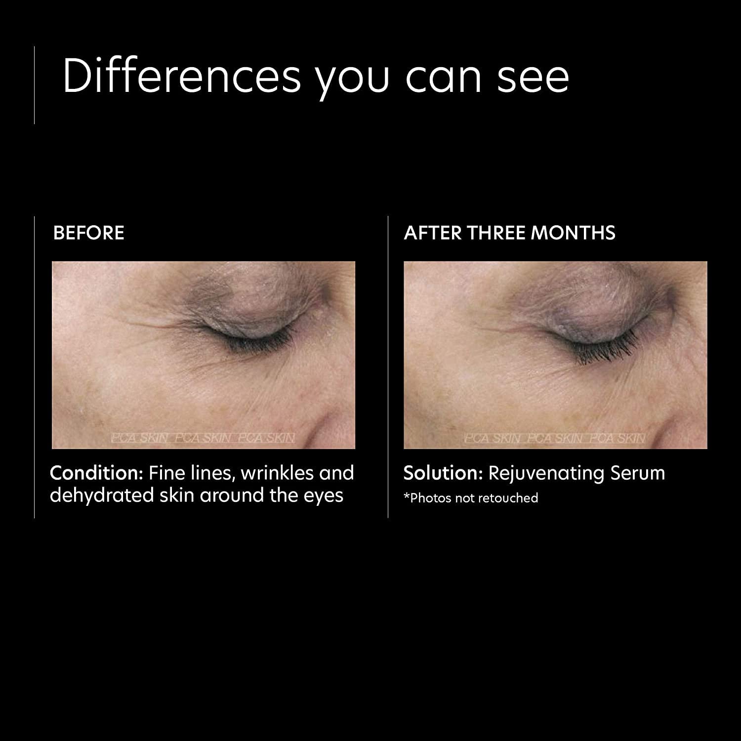 PCA Skin Rejuvenating Serum - Skin Love Cream