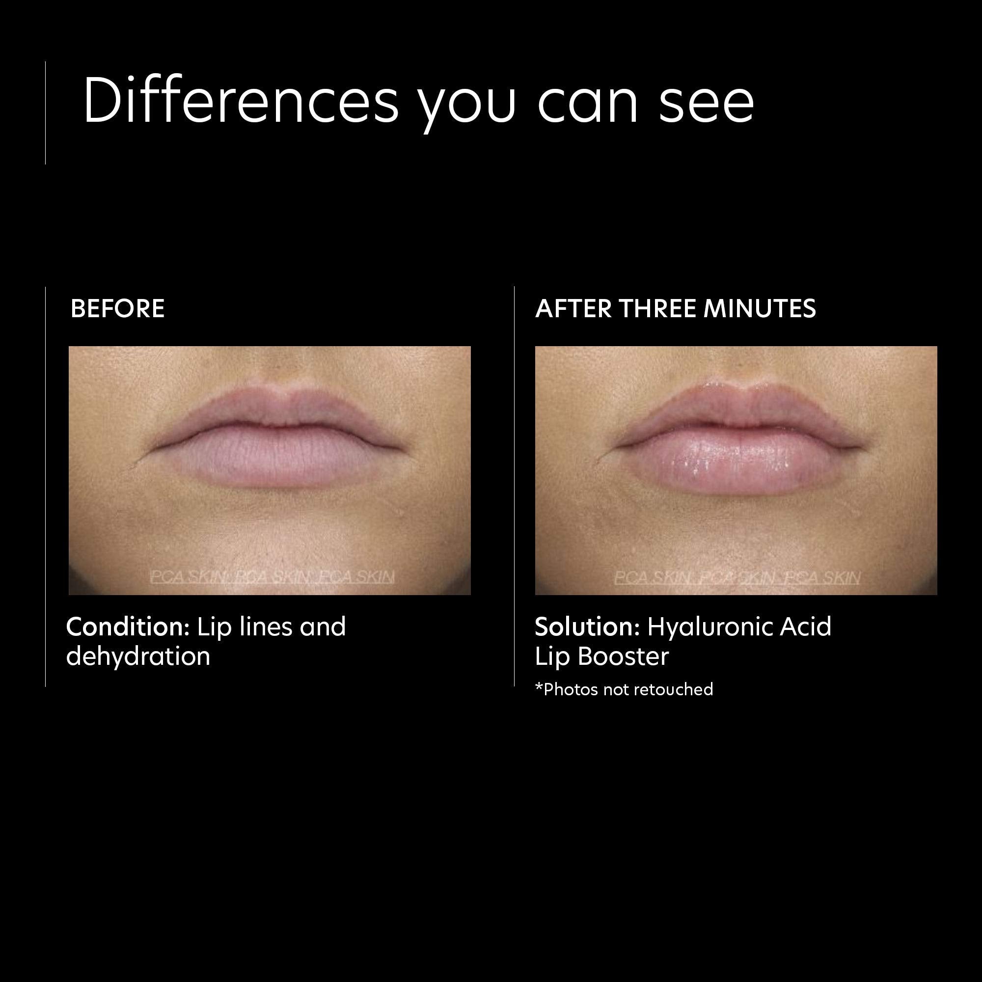 PCA Skin Hyaluronic Acid Lip Booster - Skin Love Cream