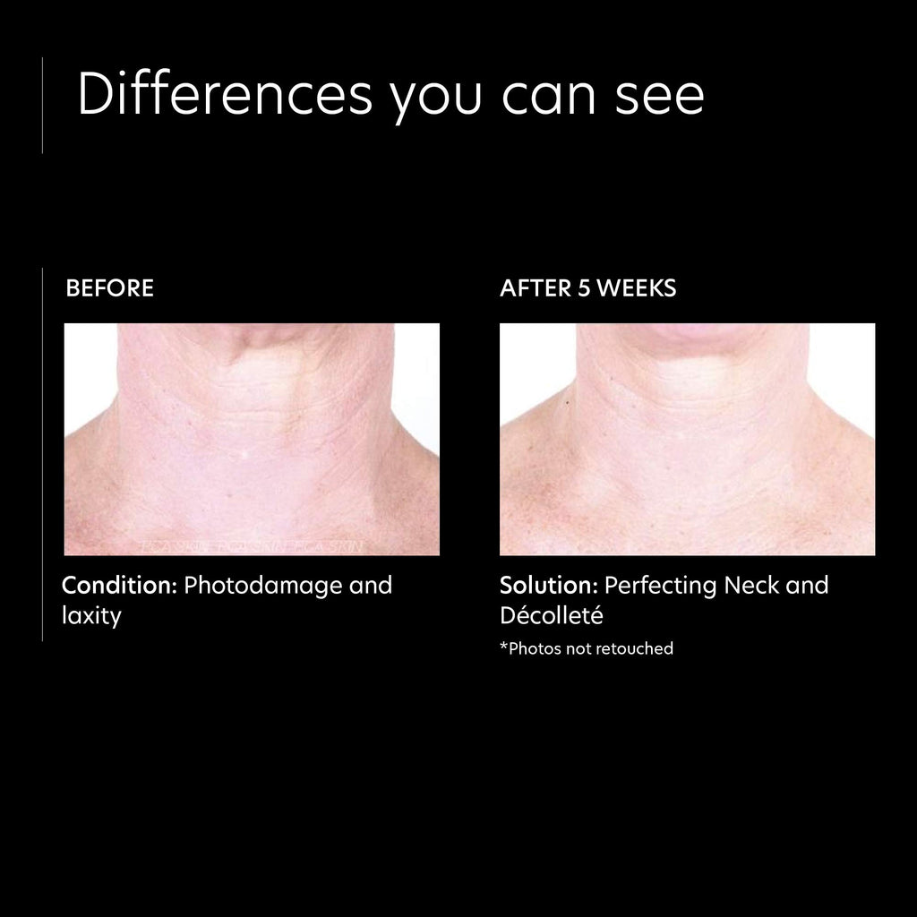 PCA Skin Perfecting Neck and Decollete