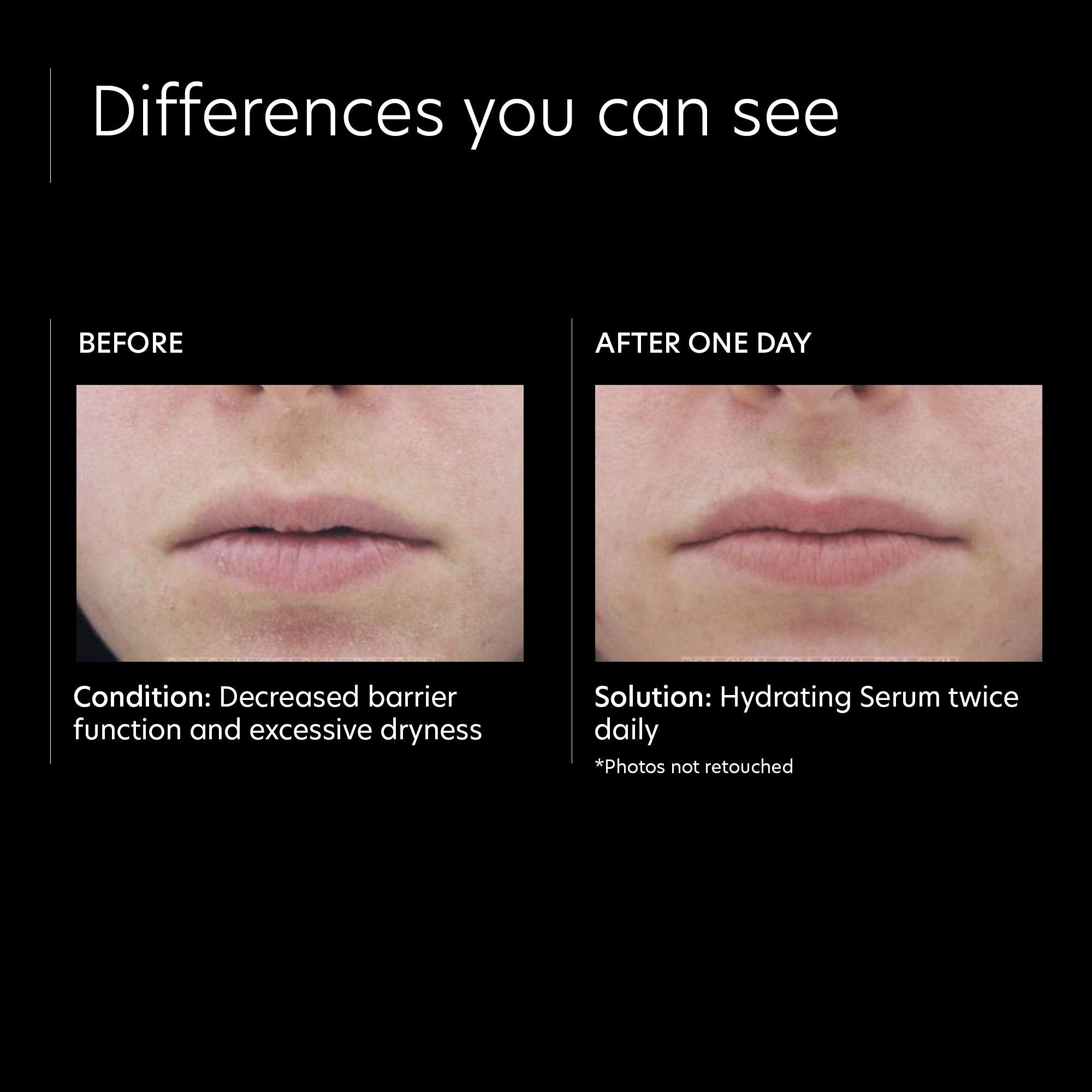 PCA Skin Hydrating Serum - Skin Love Cream