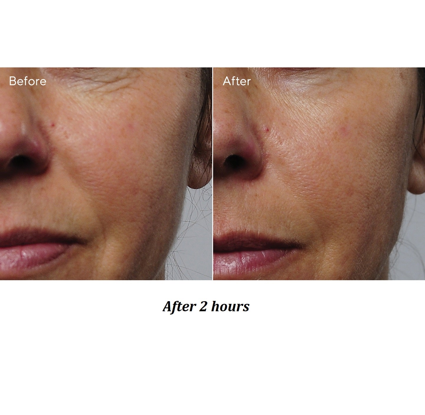 Murad Rapid Collagen Infusion - Skin Love Cream