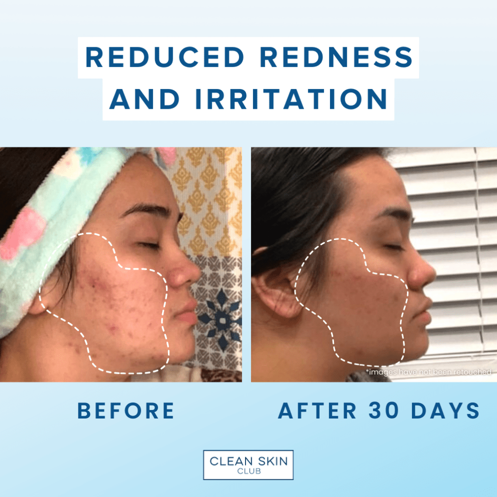 Clean Skin Club Clean Towels Xl Bamboo - Skin Love Cream