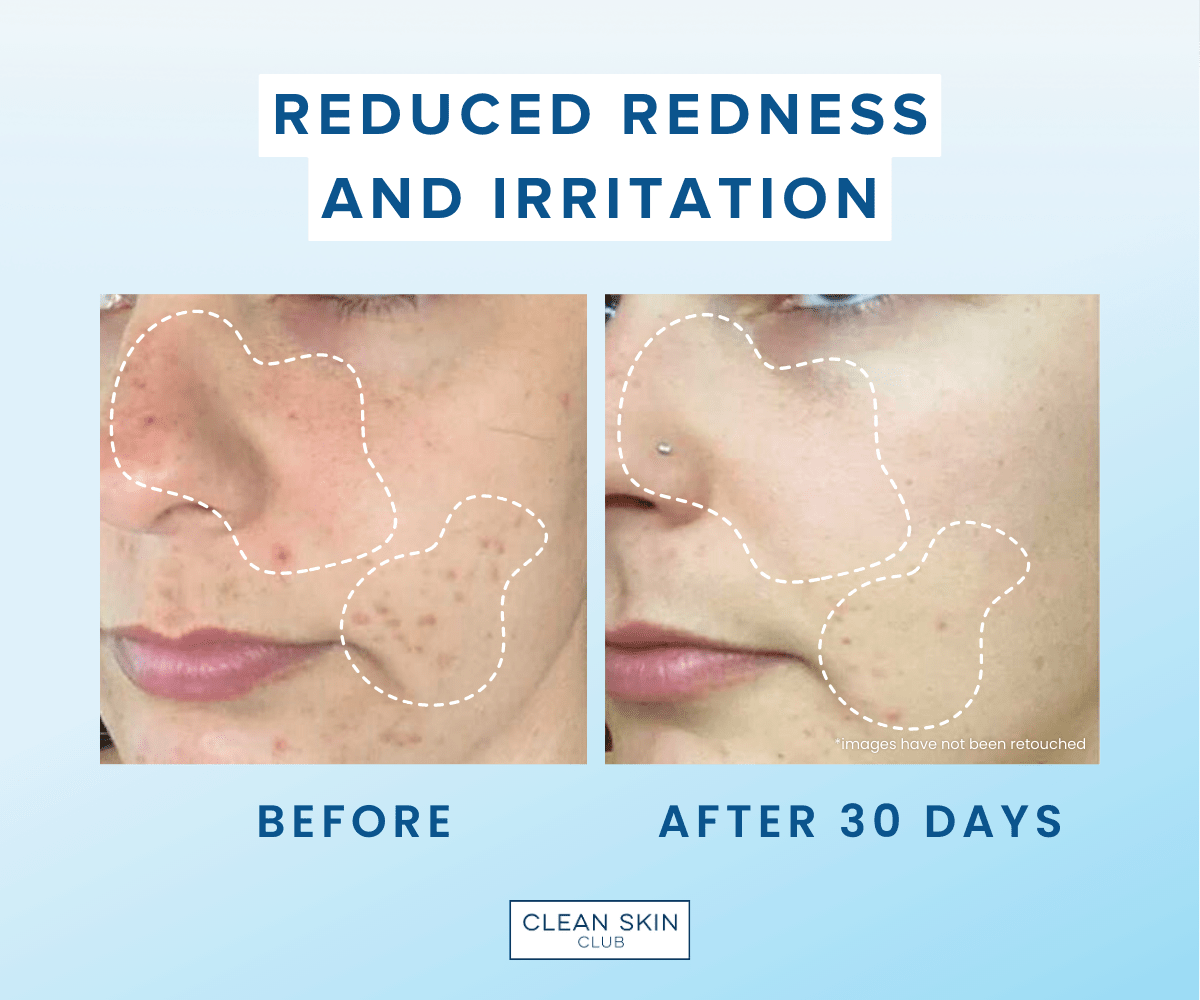 Clean Skin Club Clean Towels Xl - Skin Love Cream