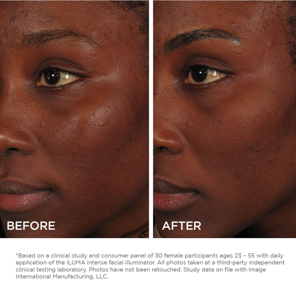 IMAGE Skincare ILUMA Face Serum