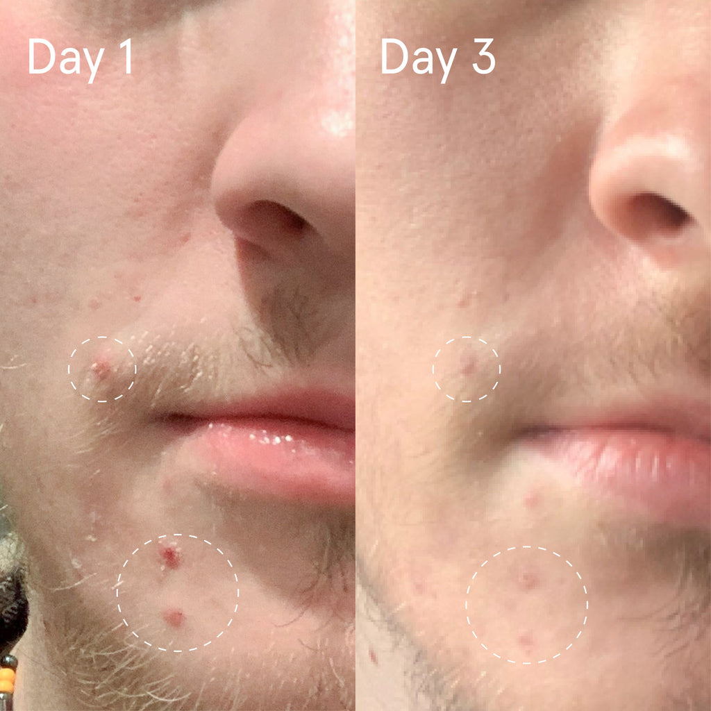 Face Reality Sulfur Spot Treatment