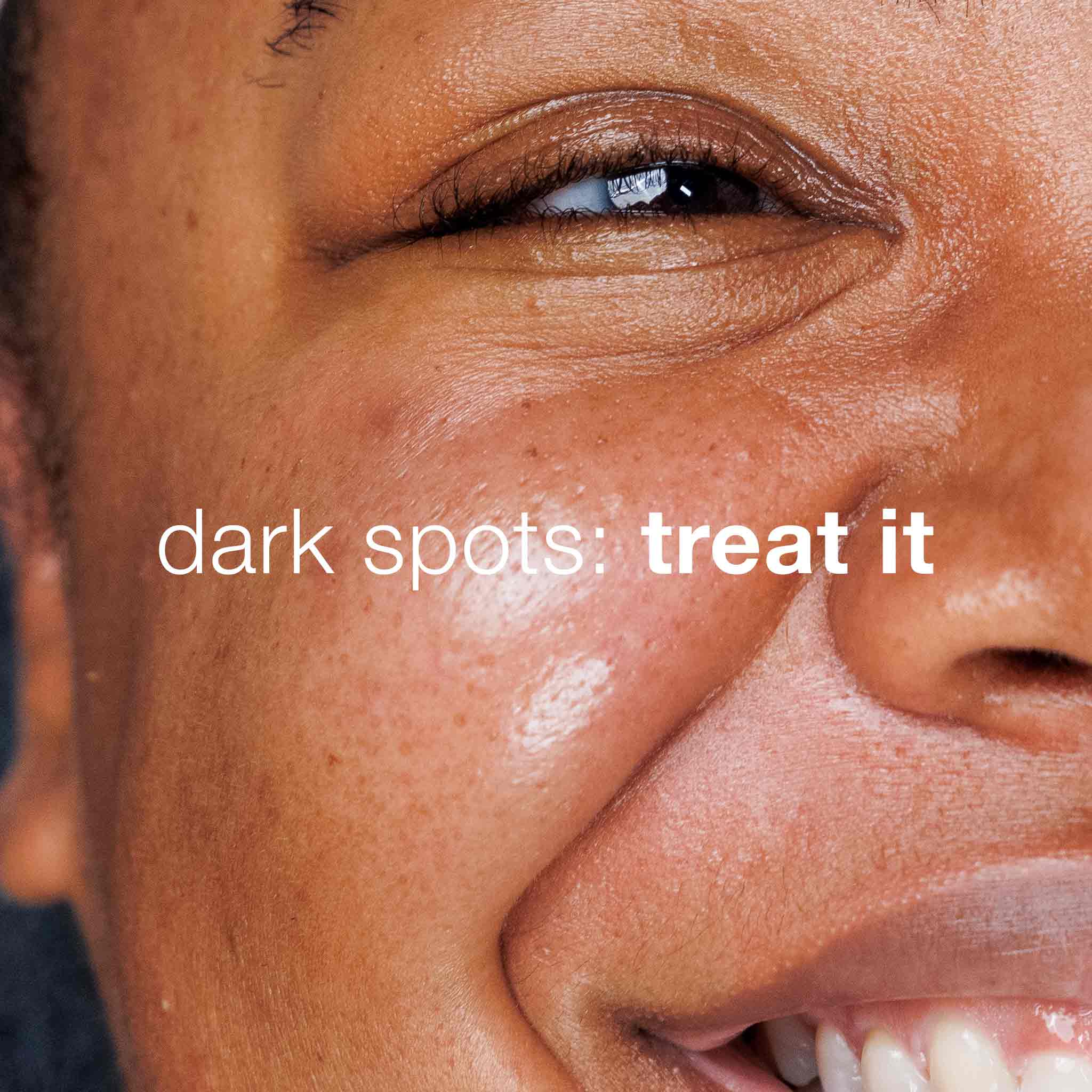 Dermalogica Dark Spot Solutions Kit - Skin Love Cream